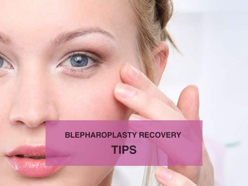 Blepharoplasty Recovery tips