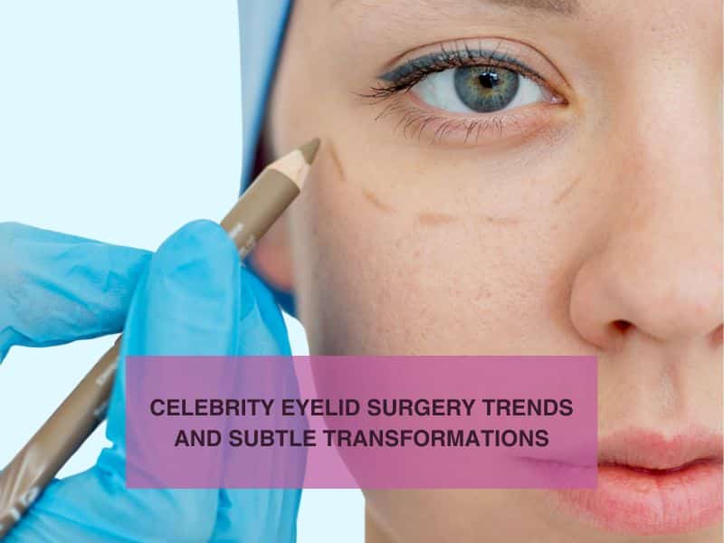 Celebrity Eyelid Surgery Trends and Subtle Transformations