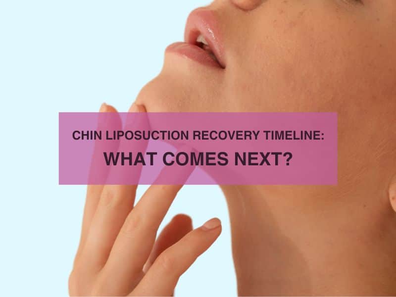 Chin Liposuction Recovery Timeline What Comes Next?