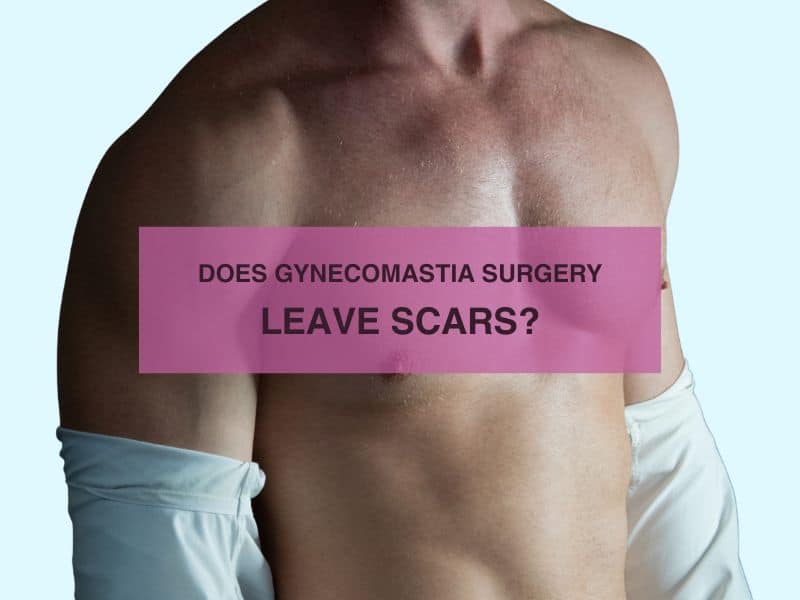 Does Gynecomastia Surgery Leave Scars?