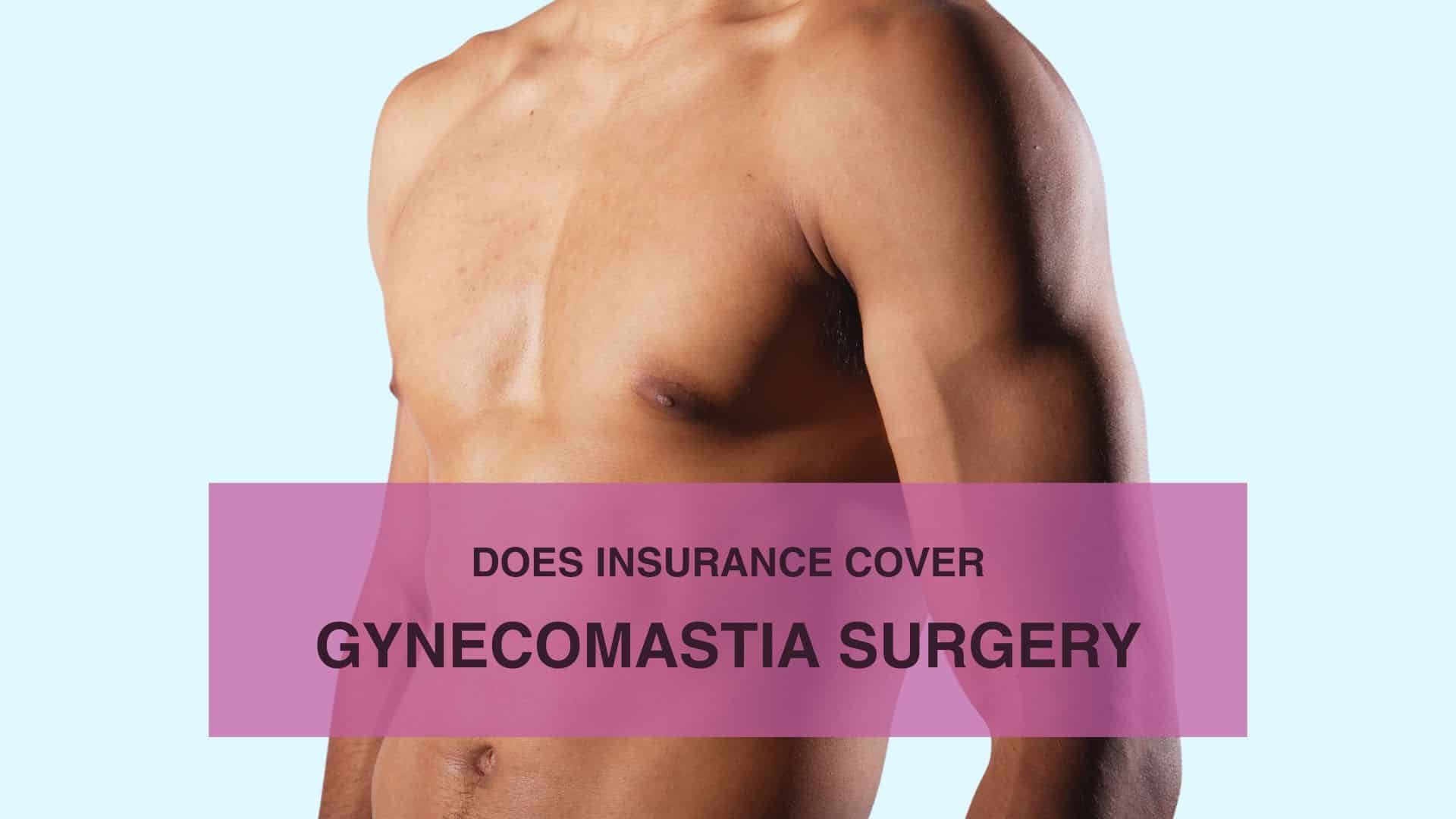 Does Insurance Cover Gynecomastia Surgery
