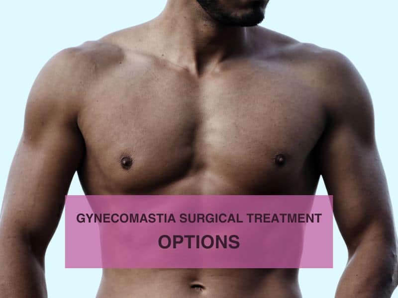 Gynecomastia Surgical Treatment Options