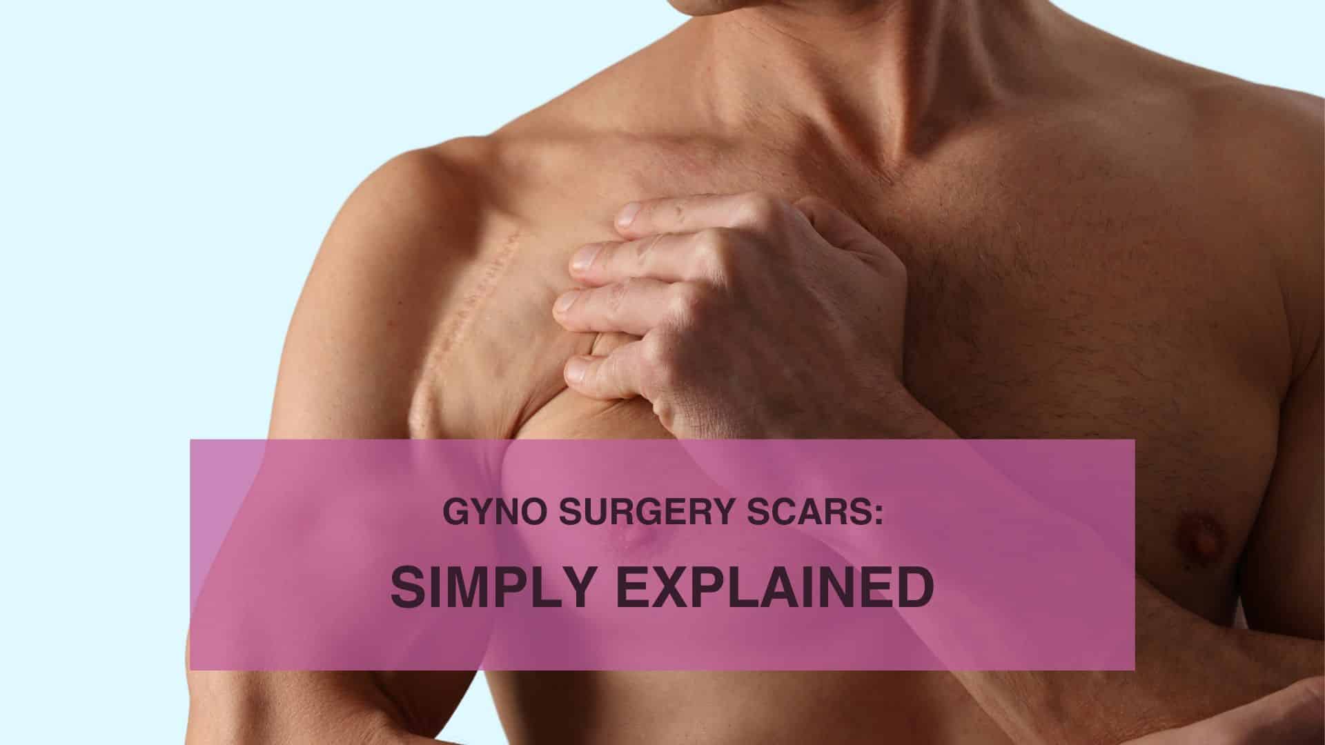 Gyno Surgery Scars: Simply Explained