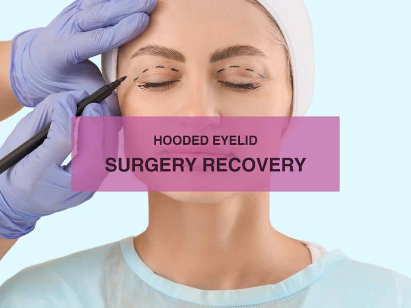 Hooded Eyelid Surgery Recovery