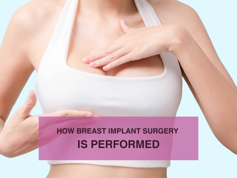 How Breast Implant Surgery Is Performed