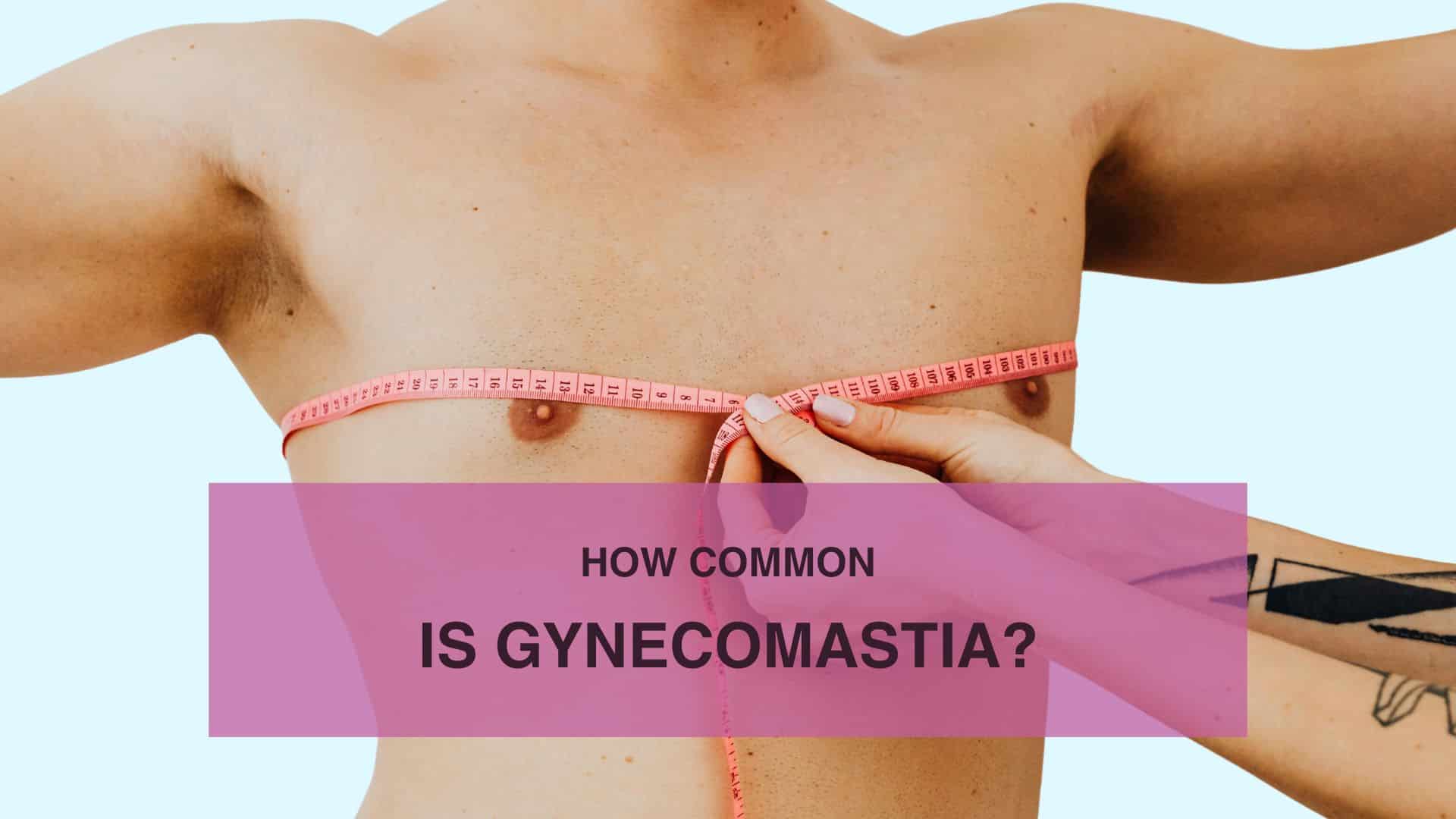 How Common Is Gynecomastia