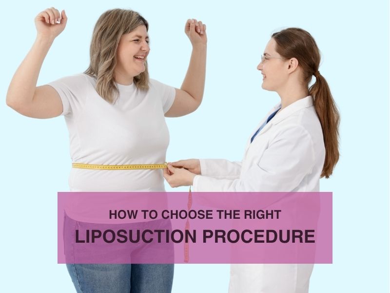 How to Choose the Right Liposuction Procedure