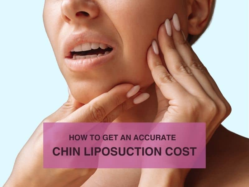 How to Get an Accurate Chin Liposuction Cost