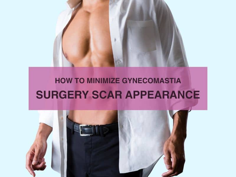 How to Minimize Gynecomastia Surgery Scar Appearance
