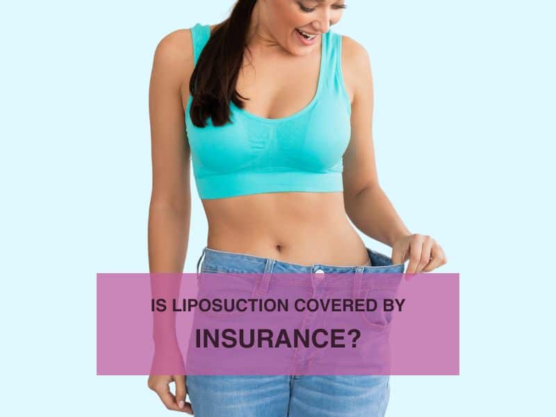 Is Liposuction Covered by Insurance