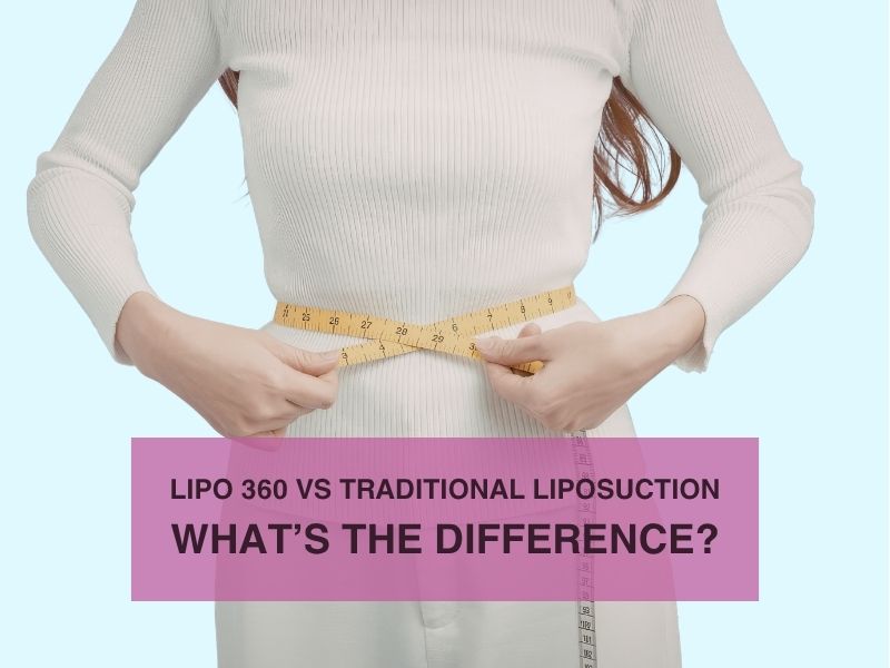 Lipo 360 vs Traditional Liposuction What’s the Difference