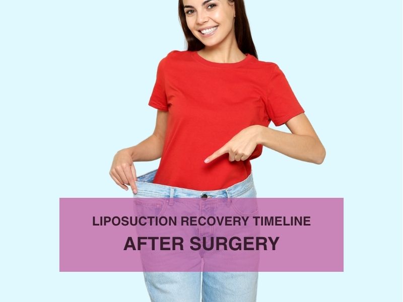 Liposuction Recovery Timeline After Surgery
