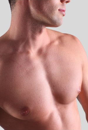 Recovery time for gynecomastia surgery
