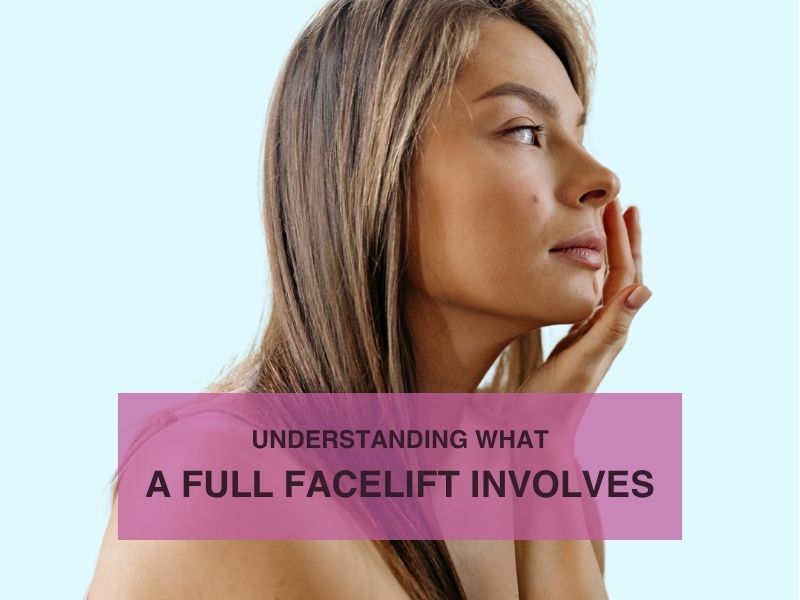 Understanding What a Full Facelift Involves