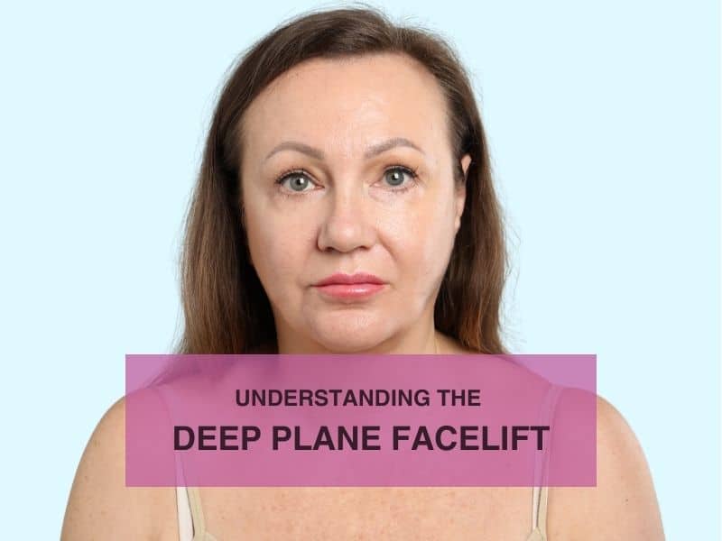 Understanding the Deep Plane Facelift