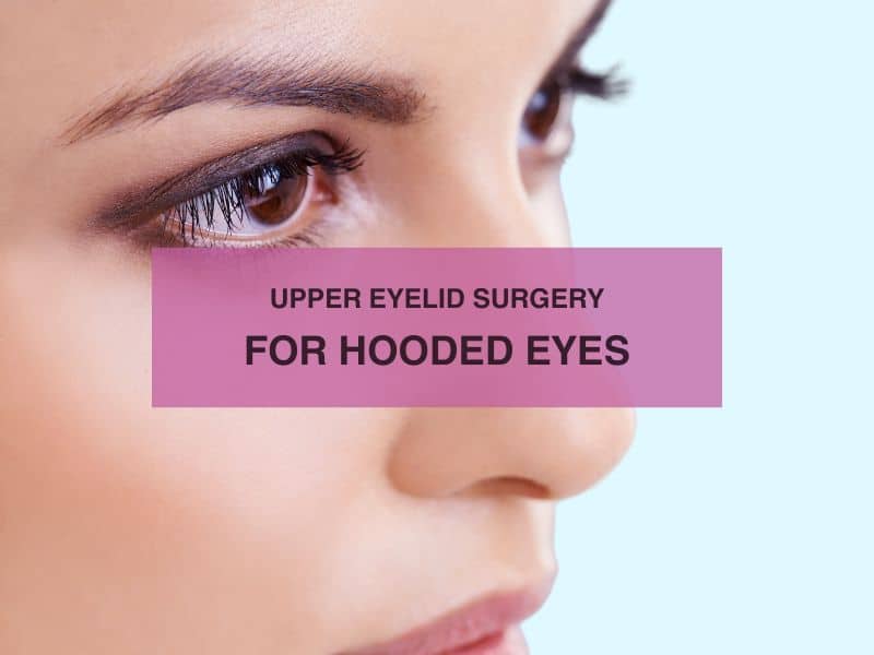 Upper Eyelid Surgery for Hooded Eyes