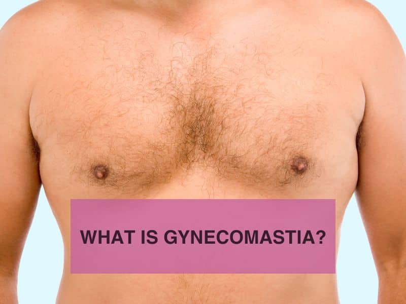 What Is Gynecomastia