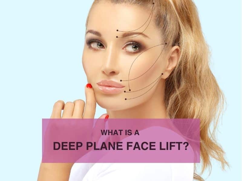 What Is a Deep Plane Face lift