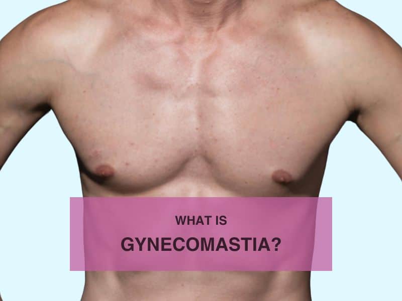 What Is Gynecomastia?