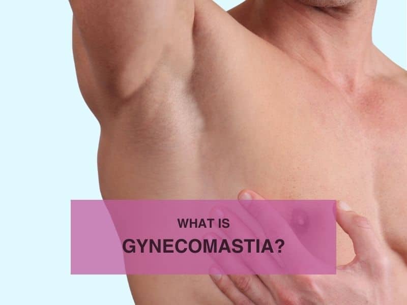 What is Gynecomastia