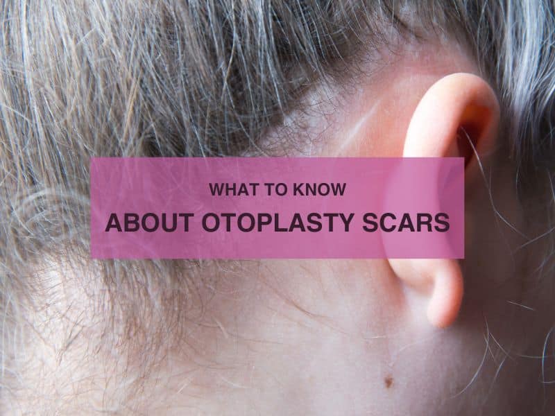 What to Know About Otoplasty Scars