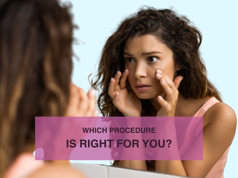 Which Procedure Is Right for You
