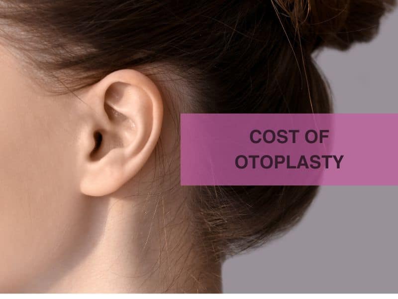 cost of otoplasty