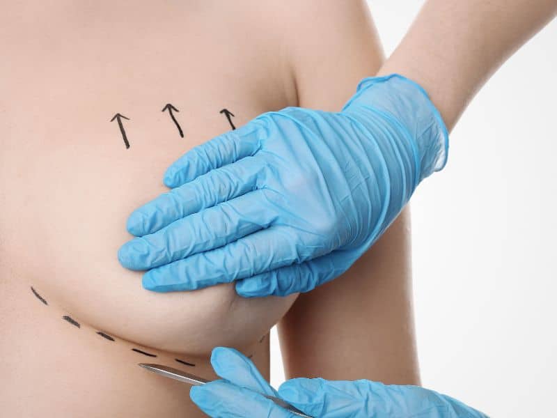 how long does it take for nipples to heal after breast lift